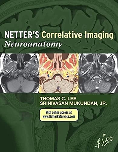 Netter's Correlative Imaging Neuroanatomy cover