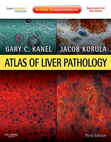 Atlas of Liver Pathology cover