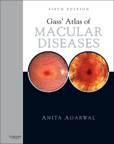 Gass' Atlas of Macular Diseases 2-Volume Set - Expert Consult: Online and Print cover