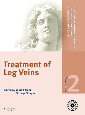 Treatment of Leg Veins cover