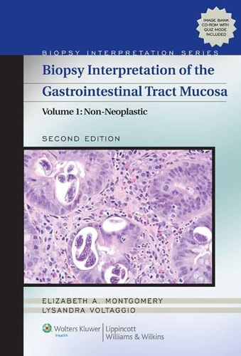 Biopsy Interpretation of the Gastrointestinal Tract Mucosa Volume 1: Non-Neoplastic cover