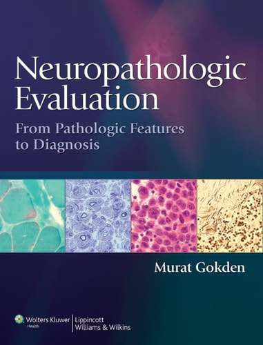 Neuropathologic Evaluation From Pathologic Features to Diagnosis cover