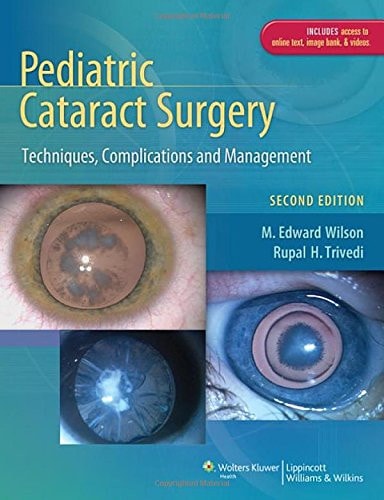 Pediatric Cataract Surgery Techniques, Complications and Management cover