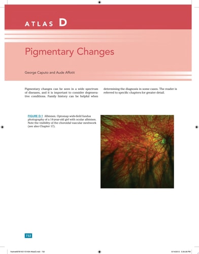 Pediatric Retina cover