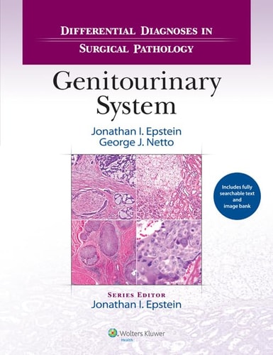Differential Diagnoses in Surgical Pathology: Genitourinary System cover