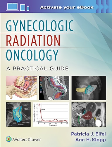 Gynecologic Radiation Oncology A Practical Guide cover