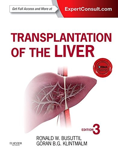 Transplantation of the Liver cover