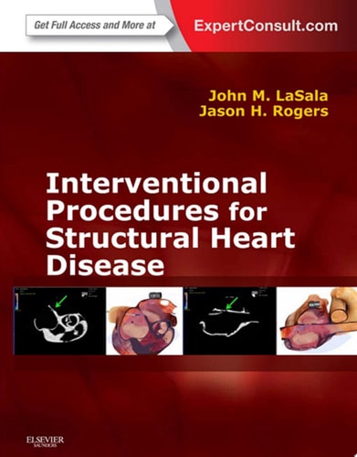 Interventional Procedures for Adult Structural Heart Disease cover