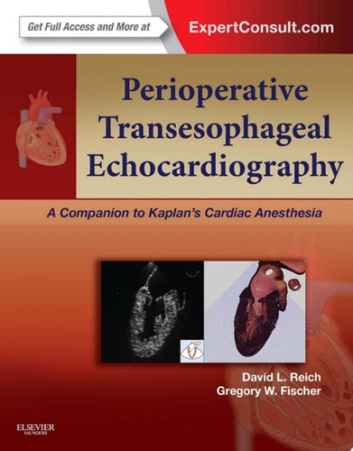 Perioperative Transesophageal Echocardiography A Companion to Kaplan's Cardiac Anesthesia (Expert Consult: Online and Print) cover