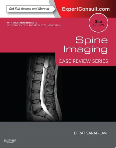 Spine Imaging: Case Review Series Expert Consult - Online and Print cover