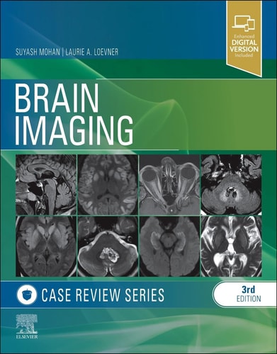 Brain Imaging Case Review Series cover