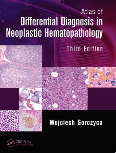 Atlas of Differential Diagnosis in Neoplastic Hematopathology, Third Edition cover