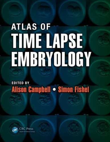 Atlas of Time Lapse Embryology cover