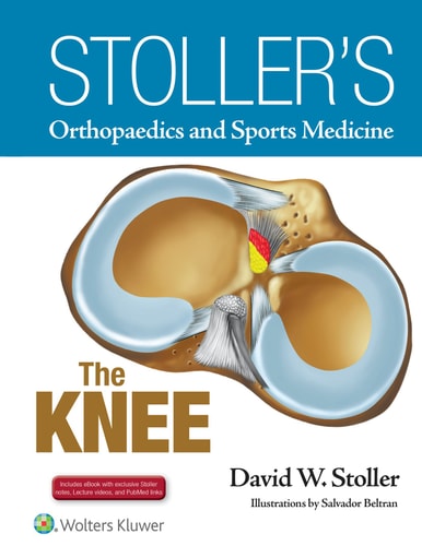 Stoller's Orthopaedics and Sports Medicine The knee cover