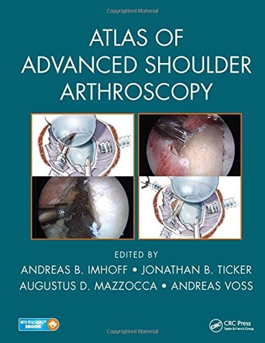 Atlas of Advanced Shoulder Arthroscopy cover