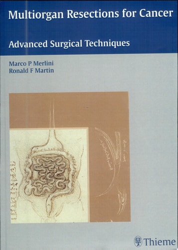 Multiorgan Resections for Cancer Advanced Surgical Techniques cover