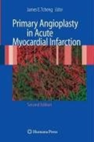 Primary Angioplasty in Acute Myocardial Infarction cover