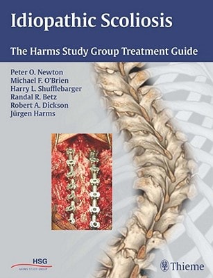 Idiopathic Scoliosis The Harms Study Group Treatment Guide cover
