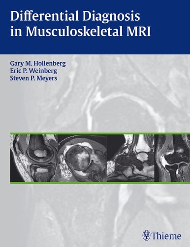 Differential Diagnosis in Musculoskeletal MRI cover