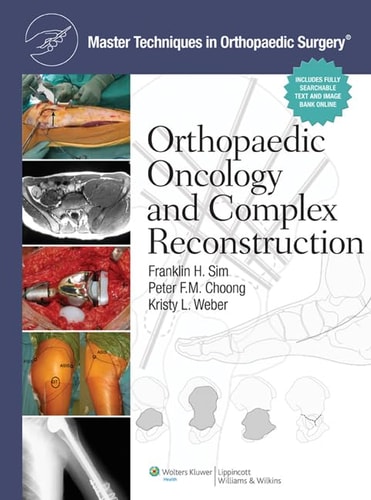 Orthopaedic Oncology and Complex Reconstruction cover