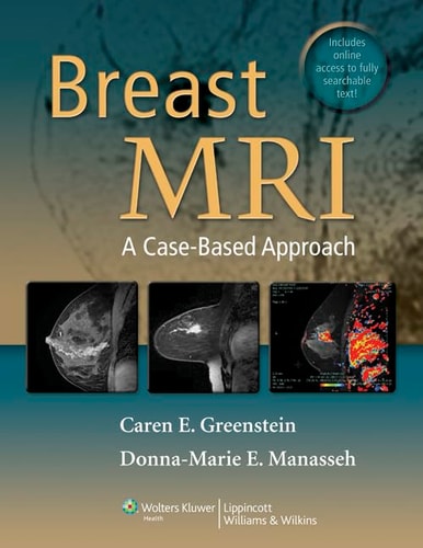 Breast MRI A Case-based Approach cover