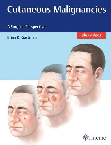 Cutaneous Malignancies A Surgical Perspective cover