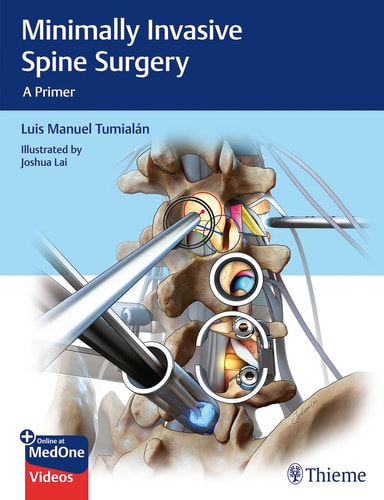 Minimally Invasive Spine Surgery A Primer cover