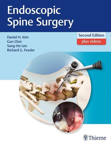 Endoscopic Spine Surgery cover
