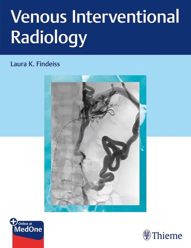 Venous Interventional Radiology cover