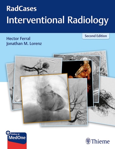 Interventional Radiology cover