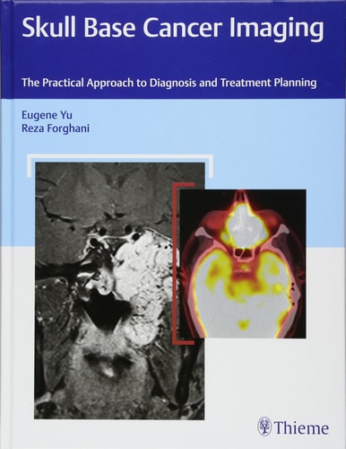 Skull Base Cancer Imaging The Practical Approach to Diagnosis and Treatment Planning cover