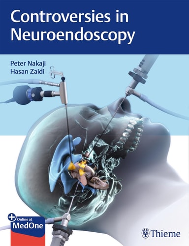 Controversies in Neuroendoscopy cover