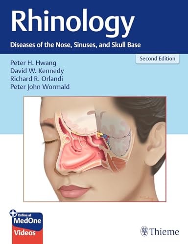Rhinology Diseases of the Nose, Sinuses, and Skull Base cover
