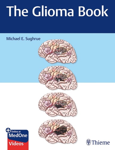 The Glioma Book cover