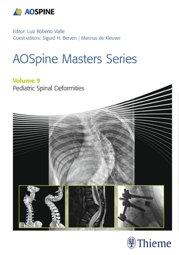 Pediatric Spinal Deformities cover