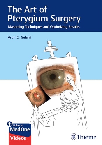The Art of Pterygium Surgery Mastering Techniques and Optimizing Results cover