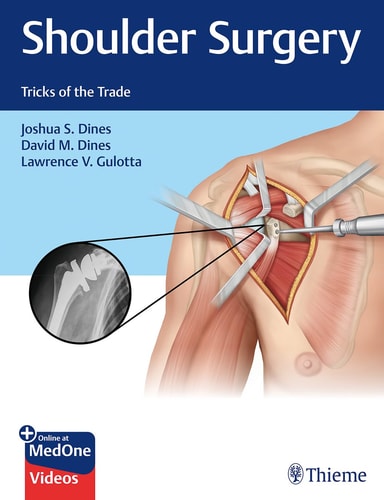 Shoulder Surgery Tricks of the Trade cover