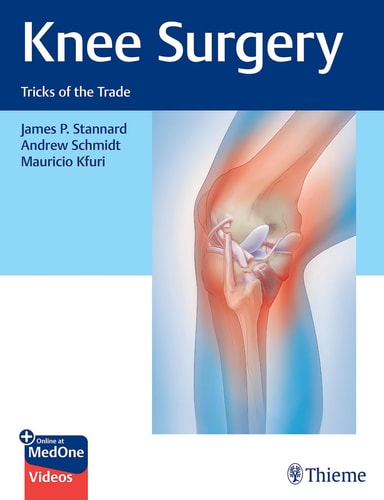 Knee Surgery Tricks of the Trade cover