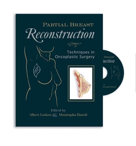 Partial Breast Reconstruction: Techniques in Oncoplastic Surgery cover