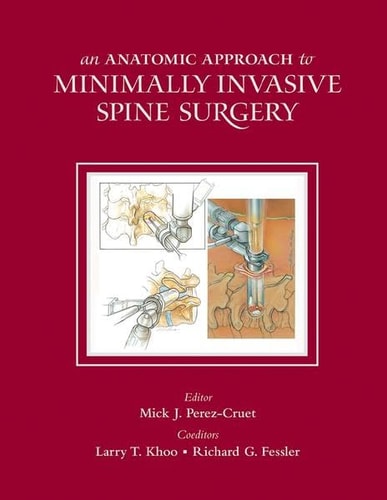 An Anatomic Approach to Minimally Invasive Spine Surgery cover