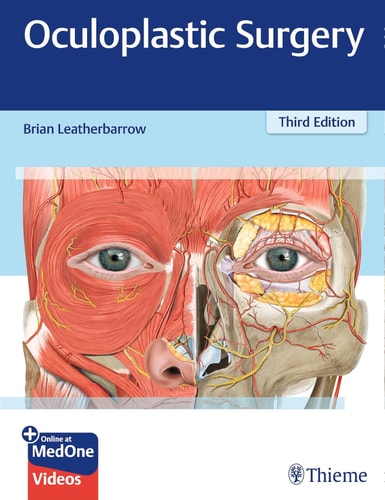 Oculoplastic Surgery cover