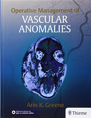 Operative Management of Vascular Anomalies cover