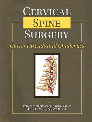 Cervical Spine Surgery Current Trends and Challenges cover