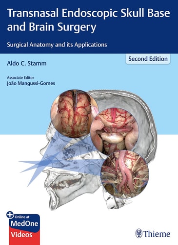 Transnasal Endoscopic Skull Base and Brain Surgery Surgical Anatomy and Its Applications cover