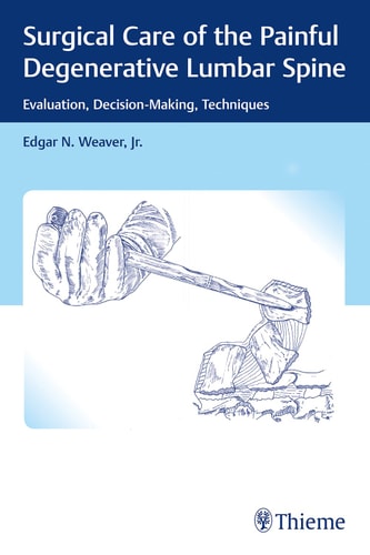Surgical Care of the Painful Degenerative Lumbar Spine Evaluation, Decision-making, Techniques cover