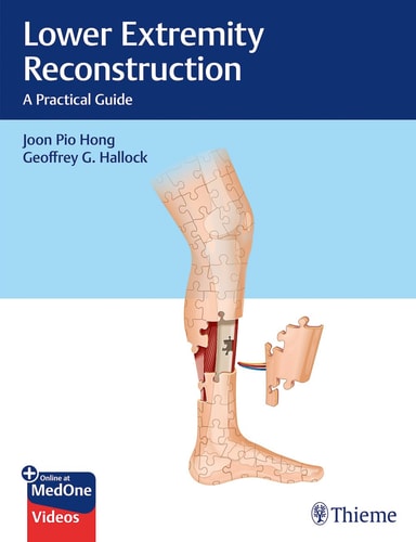 Lower Extremity Reconstruction A Practical Guide cover