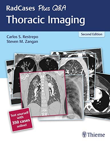 RadCases Plus Q&A Thoracic Imaging cover