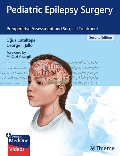 Pediatric Epilepsy Surgery Preoperative Assessment and Surgical Treatment cover