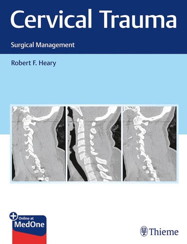 Cervical Trauma Surgical Management cover