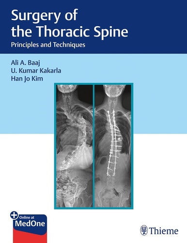 Surgery of the Thoracic Spine Principles and Techniques cover